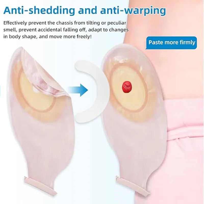 Tira de Refuerzo para Bolsa de - Medical Tape reseña y precio